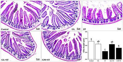 Glycyrrhizin Attenuates Salmonella Typhimurium-Induced Tissue Injury, Inflammatory Response, and Intestinal Dysbiosis in C57BL/6 Mice